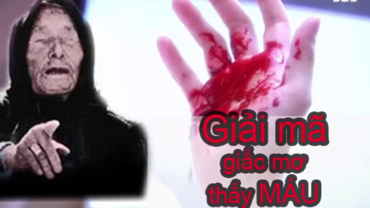 Ngủ thấy máu nên làm gì